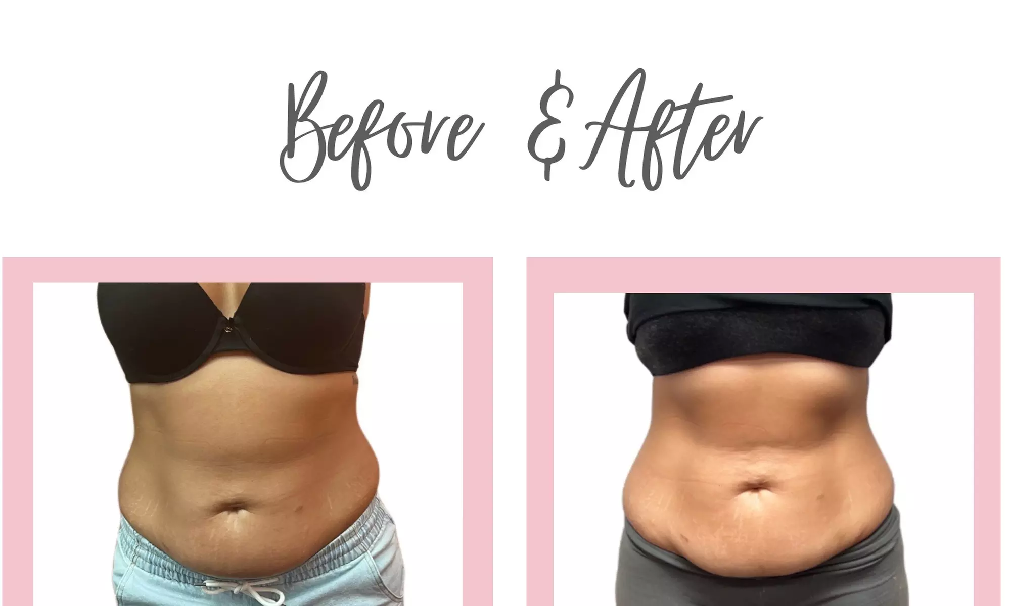 Up to 24% Off on Ultrasonic Fat Reduction at Bodied & Beyond Studios