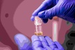 Up to 56% Off on Aquagold Microinjection Treatment - Second Medium