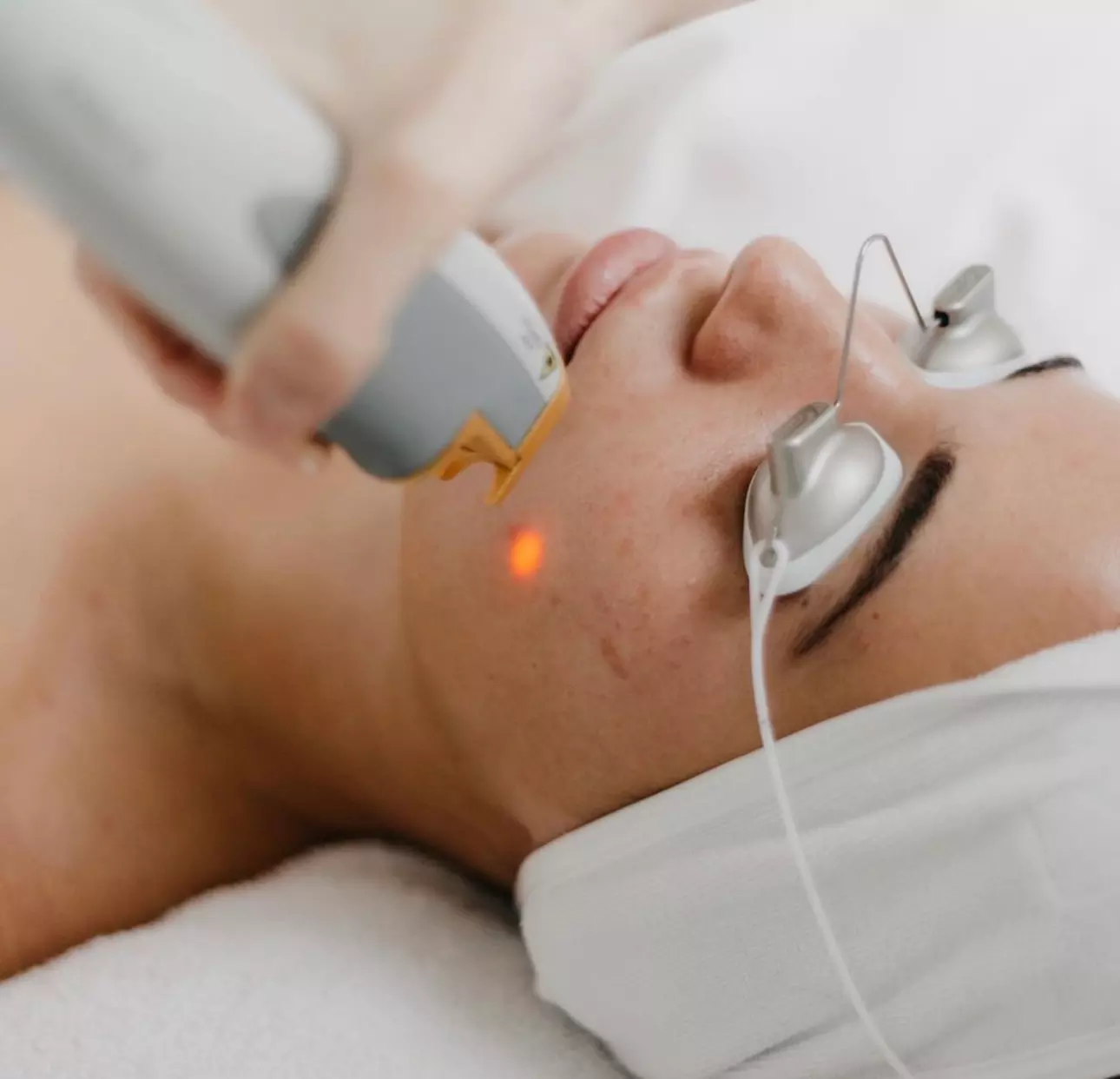 Up to 58% Off on Laser Skin Resurfacing - Branded 