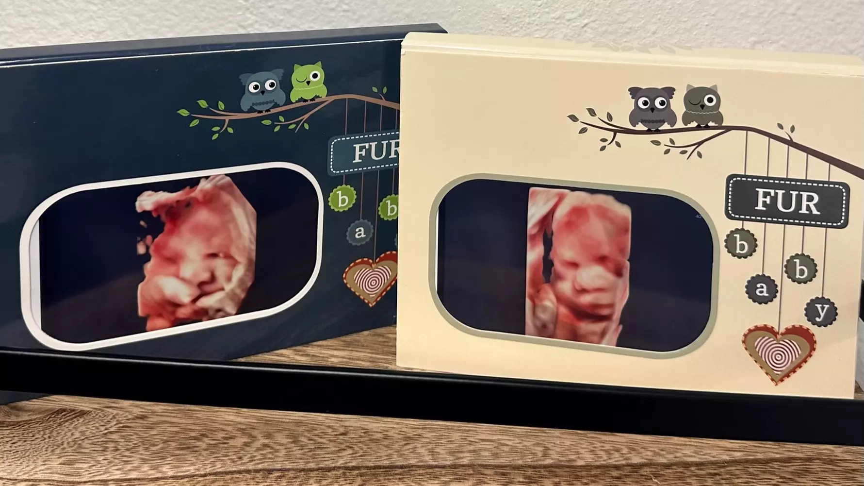 Up to 37% Off on Ultrasound - 3D / 4D at BabySelfie