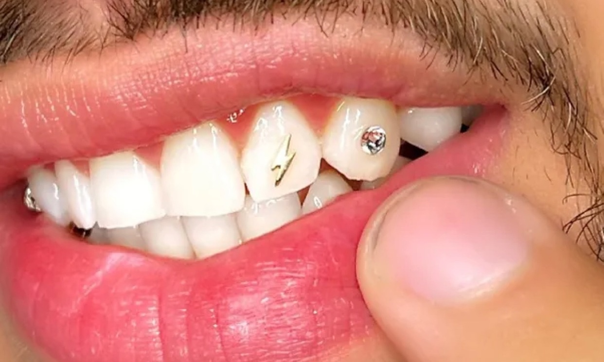 Up to 50% Off on Teeth Cleaning at Allure