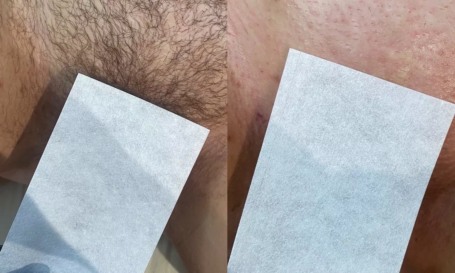 Experience Brattybrowzz's Brazilian Wax & Underarm Combo with 50% off Back Facial - Primary Image