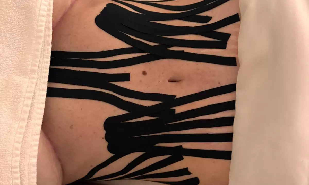 Unwind with One, Three or Five Post Op Lymphatic Drainage Massage