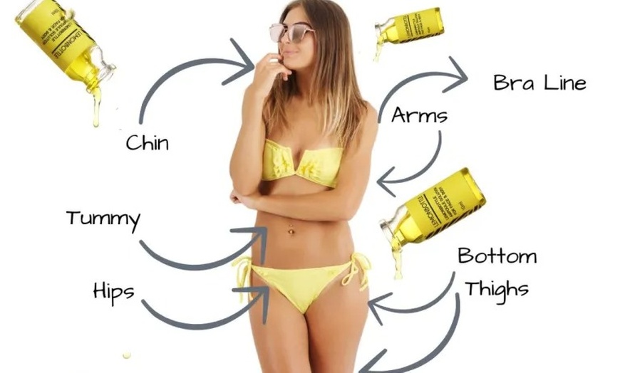 Image 1: Up to 65% Off on Injection Therapy at UK Aesthetics Lounge