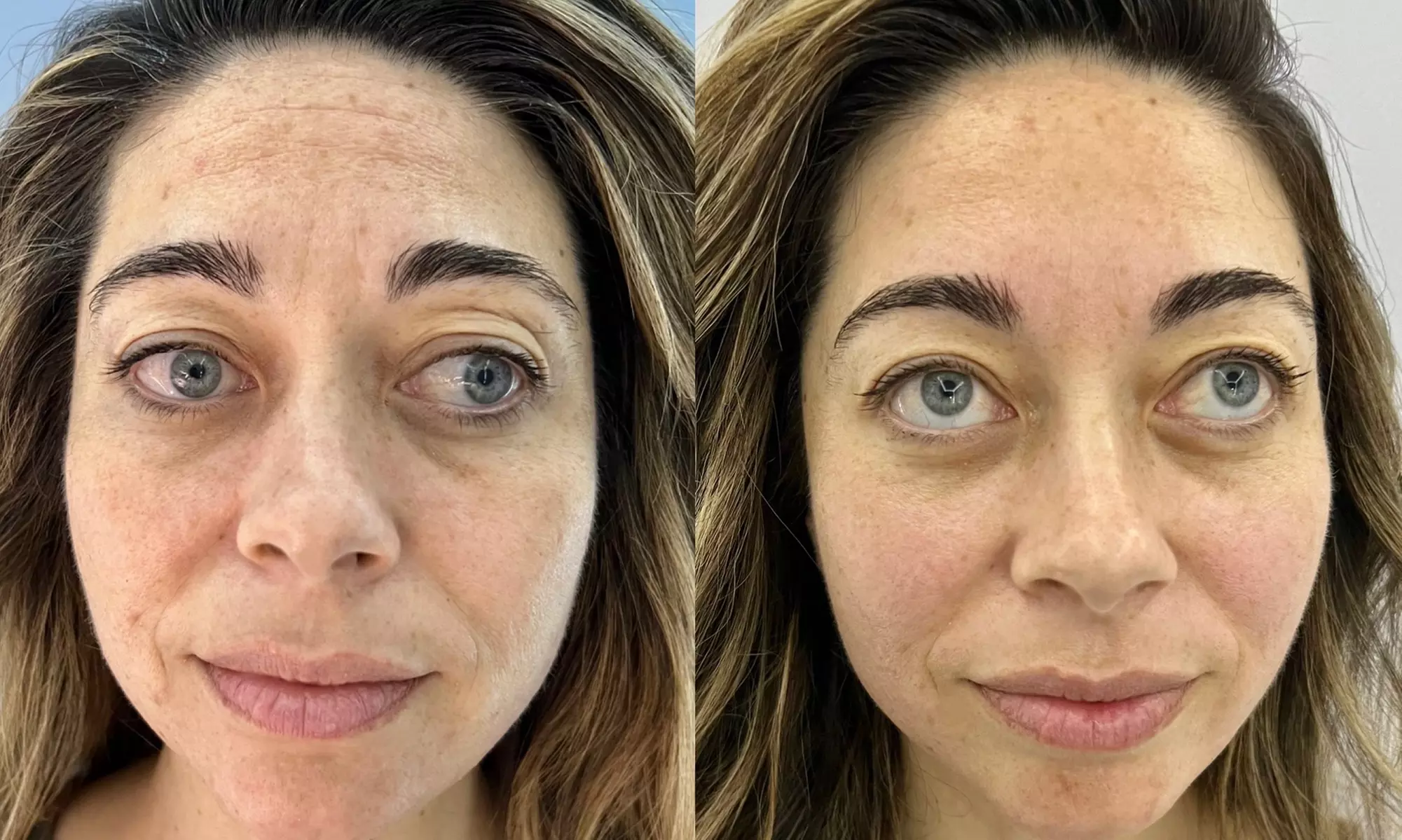 Experience EMPATH Cryo T-Shock's Glow Up and Anti-Aging Facial Refresh services with up to 37% off for radiant skin - Second Medium