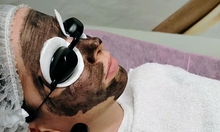 Image 1: Laserowy peeling węglowy