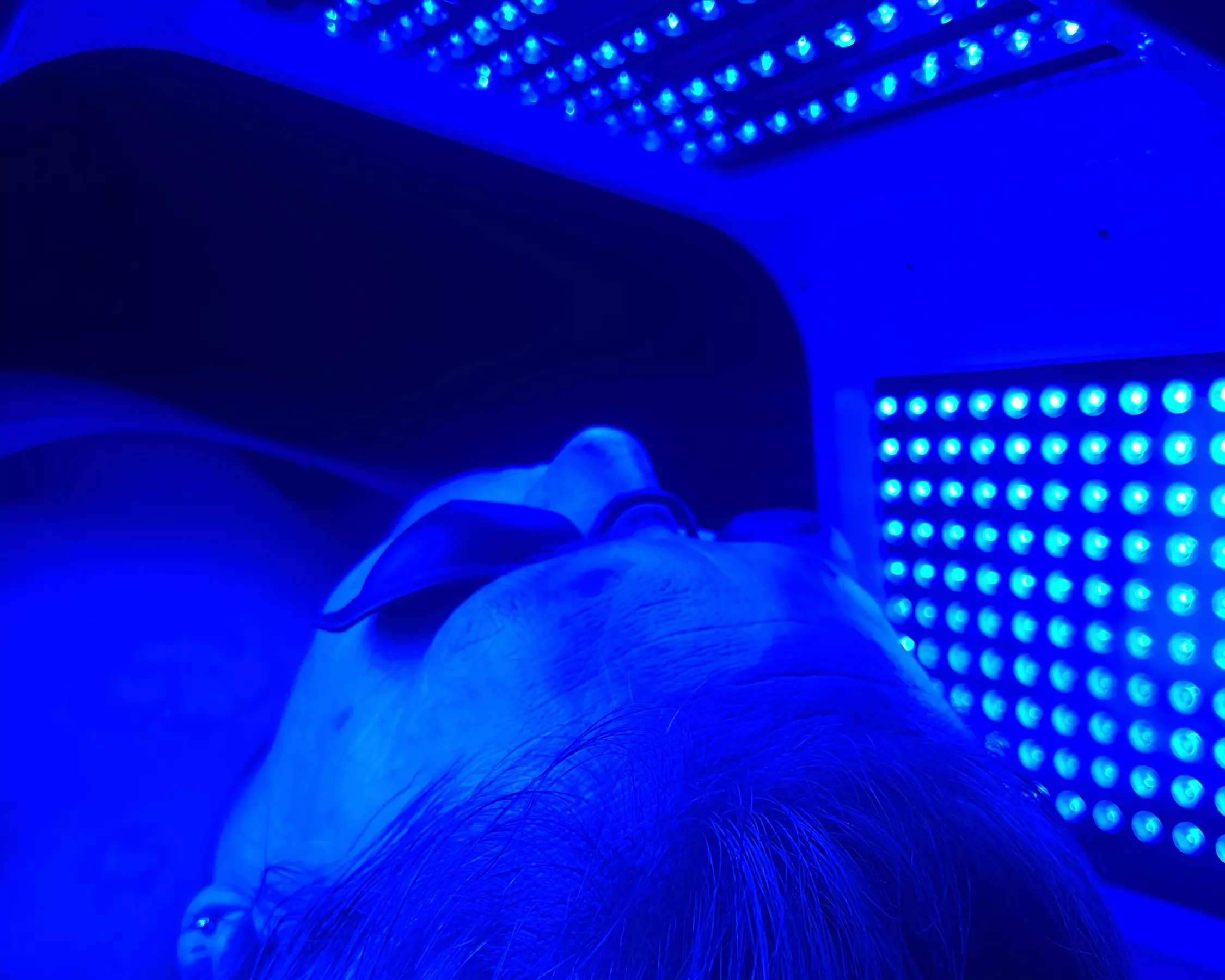 Up to 33% Off on Facial - Chosen by Customer at Radiant Rays Skin Studio