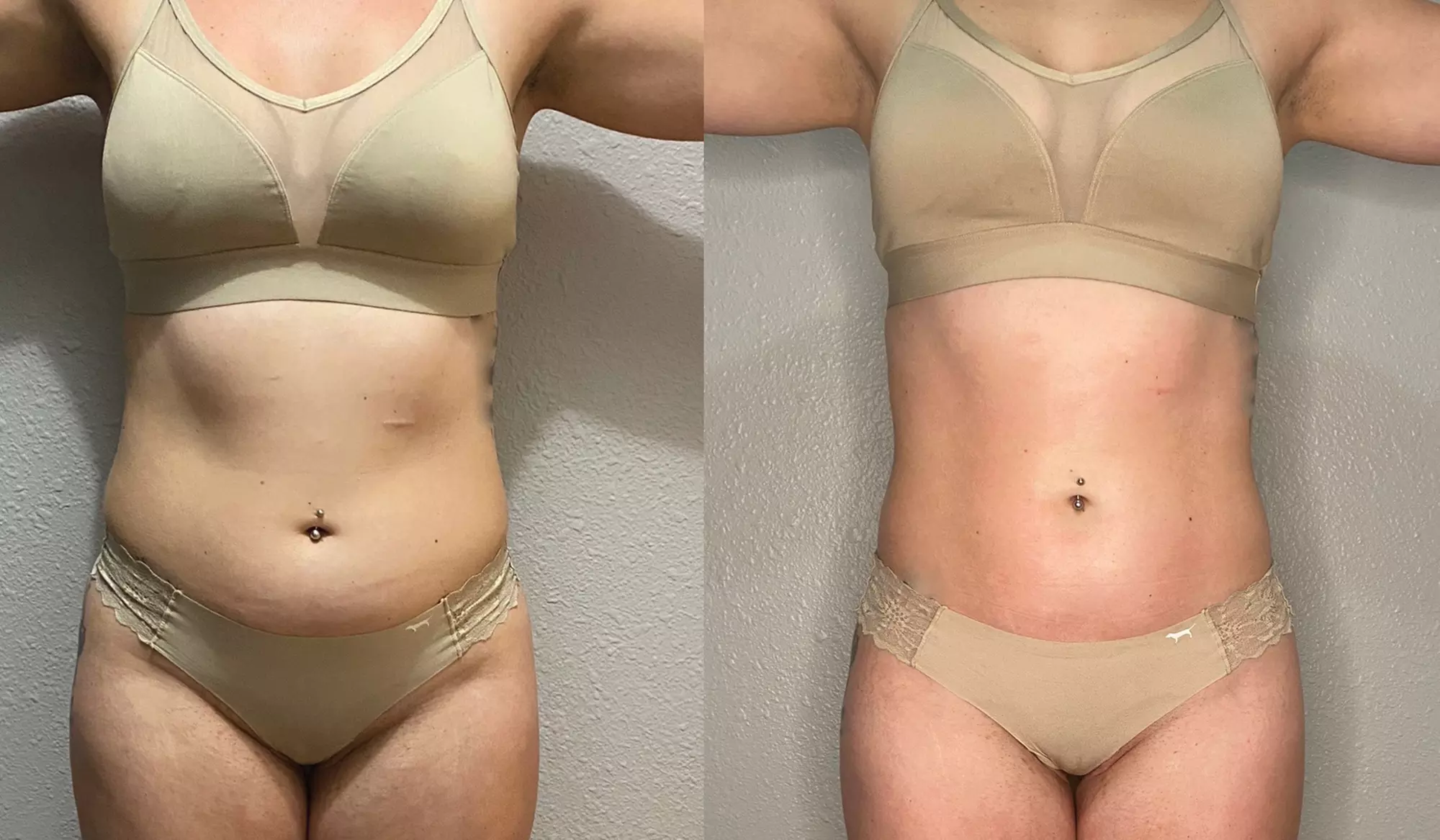 Tone Your Body with One, Two, Three or Four 45 Min Ultrasonic Cavitation with Red Light Therapy (Up to 50%Off) - Primary Image