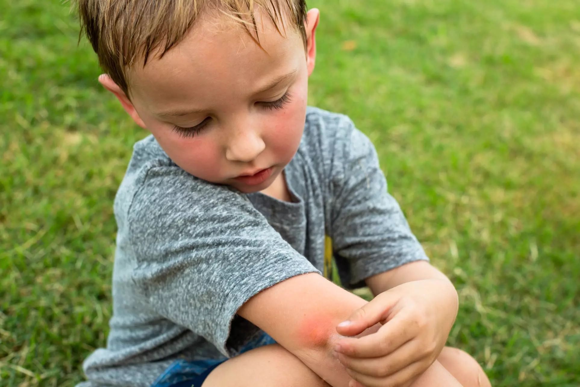 Enjoy Mosquito Control with Mosquito Shield - Long Island's Treatment!
