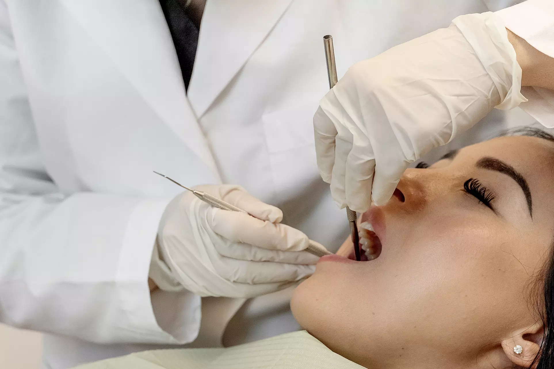 Up to 79% Off on Dental Checkup at baysmiles dental