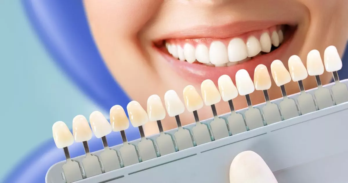 Get a Brighter Smile with LED Teeth Whitening Sessions