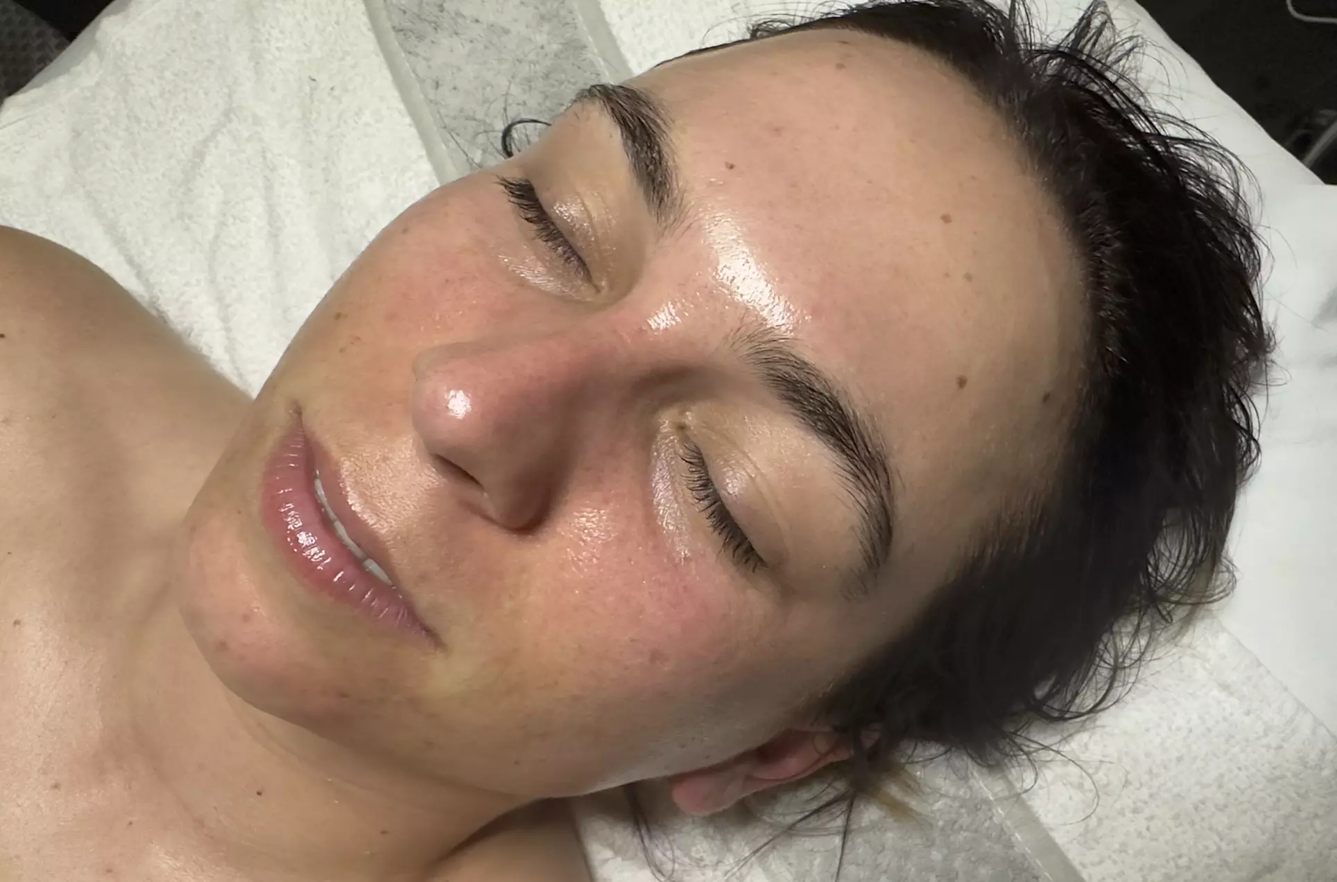 Up to 52% Off on Chemical Peel at Skin Ceremony Studio - Primary Image