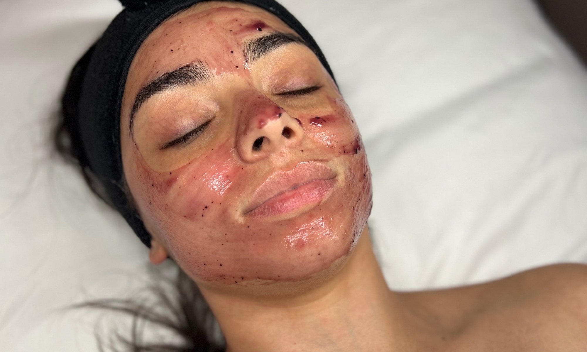 One or Three Exfoliating Facials at PureVee Esthetics
