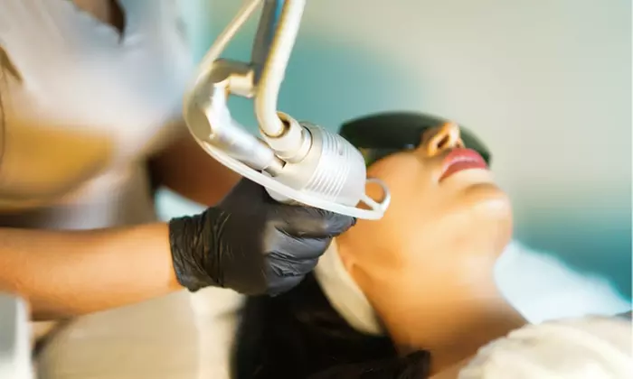 Up to 45% Off on One CO2 Fractional Laser at Exalted Beauty Med Spa - Primary Image