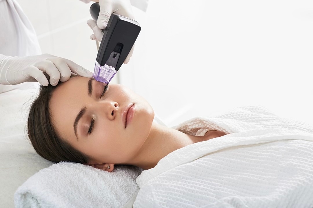 Up to 42% Off on Micro-Needling at Recharge Lab