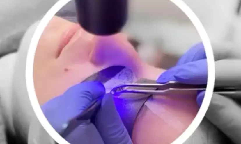 Up to 46% Off on LED Eyelash Extensions at Luxelashe in Ethereal Rejuvenation - Primary Image