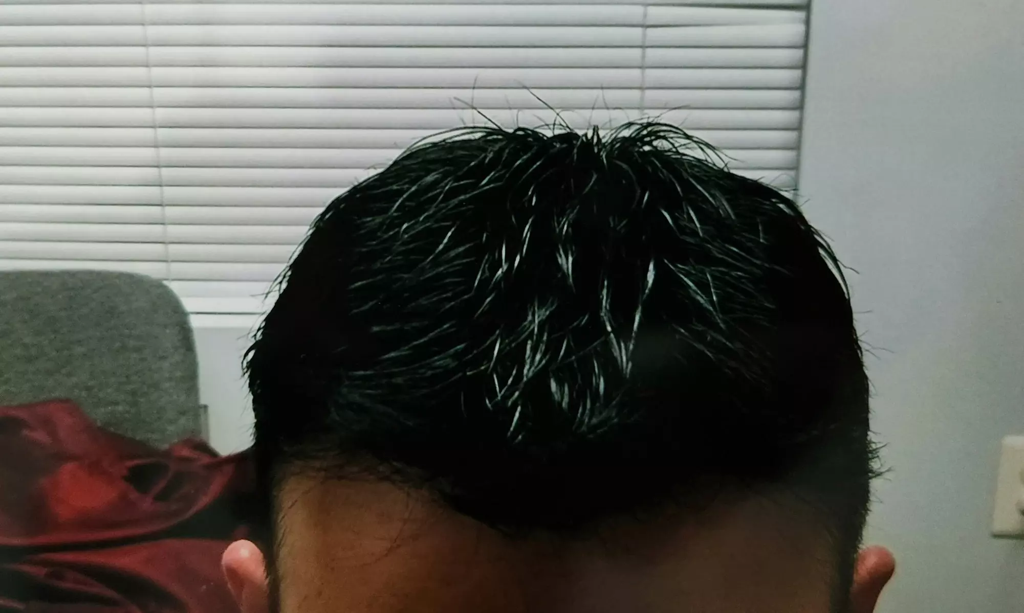 $157 Off $350 Worth of Hair Restoration - Other - Primary Image
