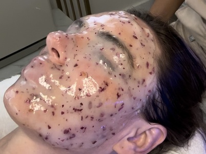 70 min Luxe Wet Diamond HydraFacial PLUS luxury Jelly mask - Blossom Aesthetics