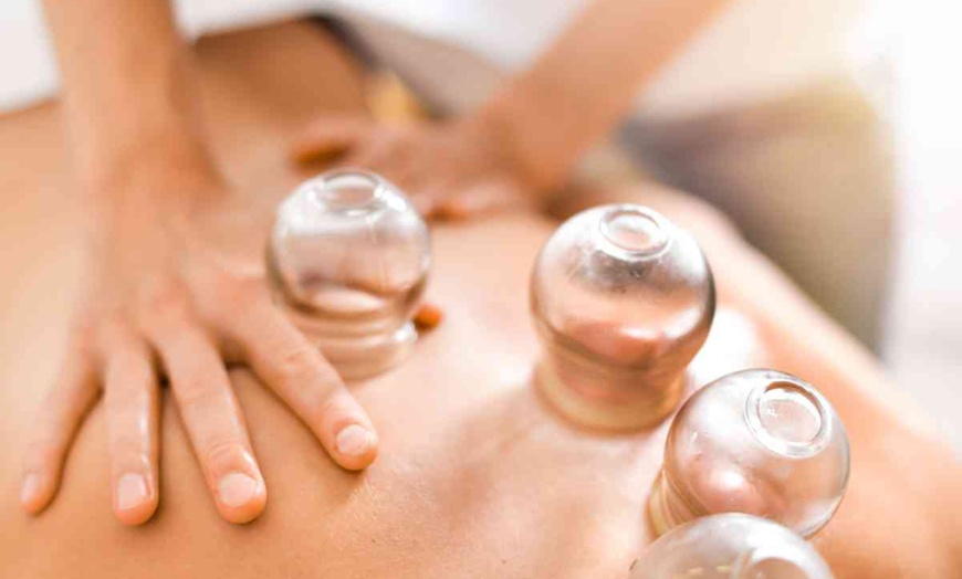 Image 3: One, Two, or Three — Dynamic Acupuncture Sessions