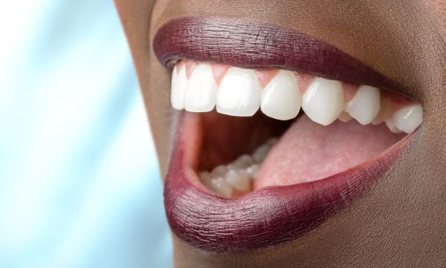 Image 1: Brighten Your Smile with One or Two Teeth Whitening Treatments