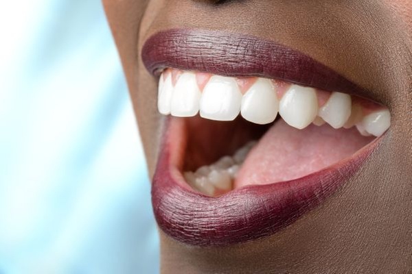 Brighten Your Smile with One or Two Teeth Whitening Treatments