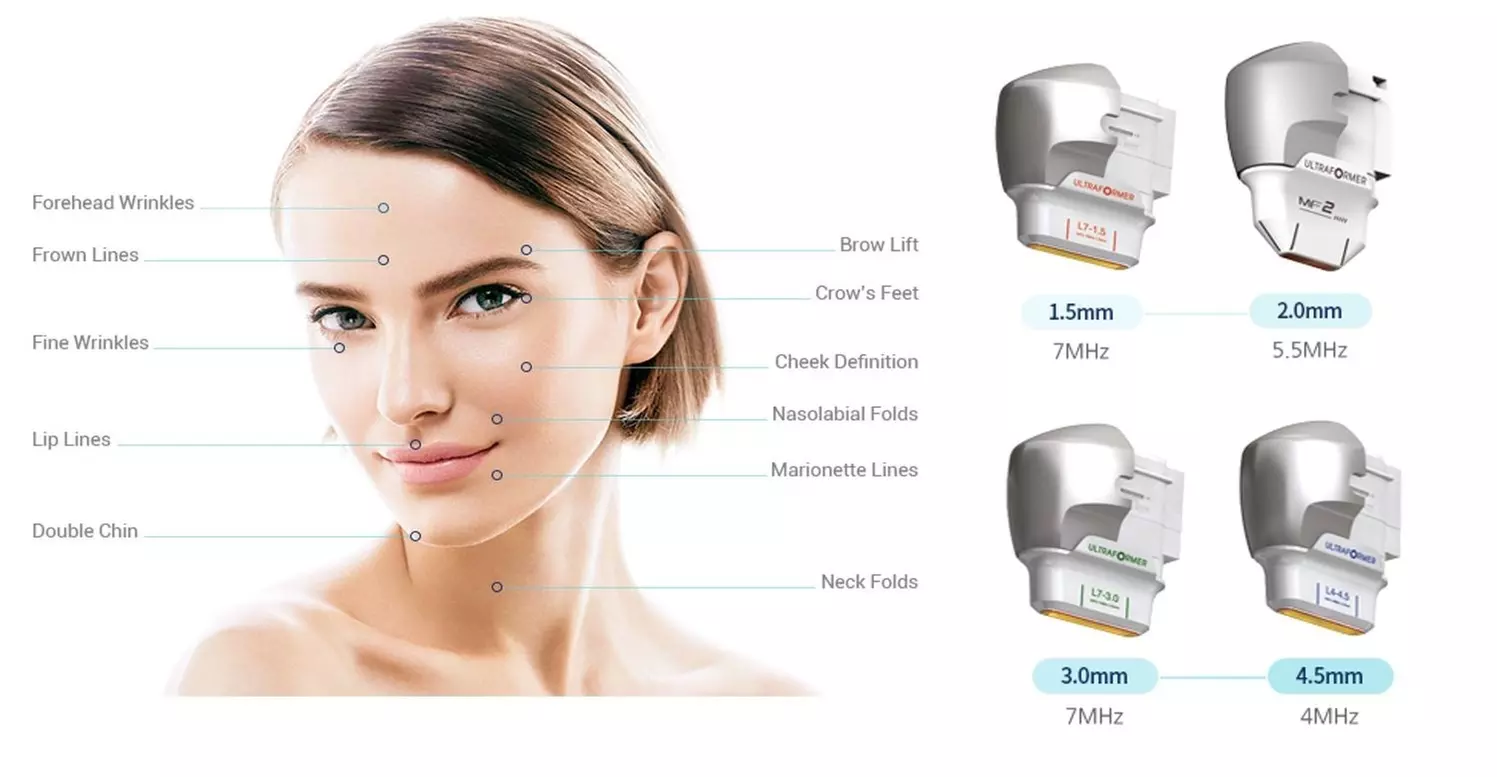 Up to 74% Off on Facial - Ultherapy / Ultrasonic at Shaded And Bladed
