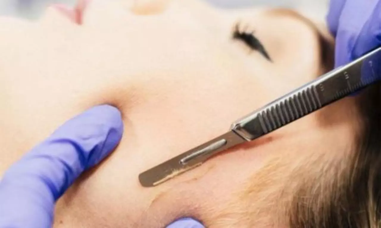 Up to 44% Off on Anti-Aging Facial at IGLOW Medi spa - Primary Image