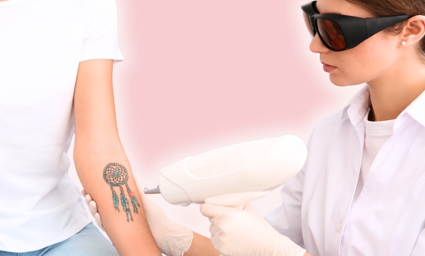 Image 1: Enjoy Three Precision Laser Sessions for Tattoo Removal 