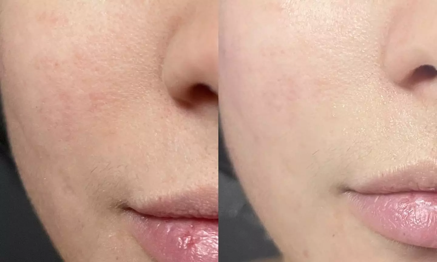 Up to 53% Off on Facial - Pore Care at Glo Up By Kara - Primary Image