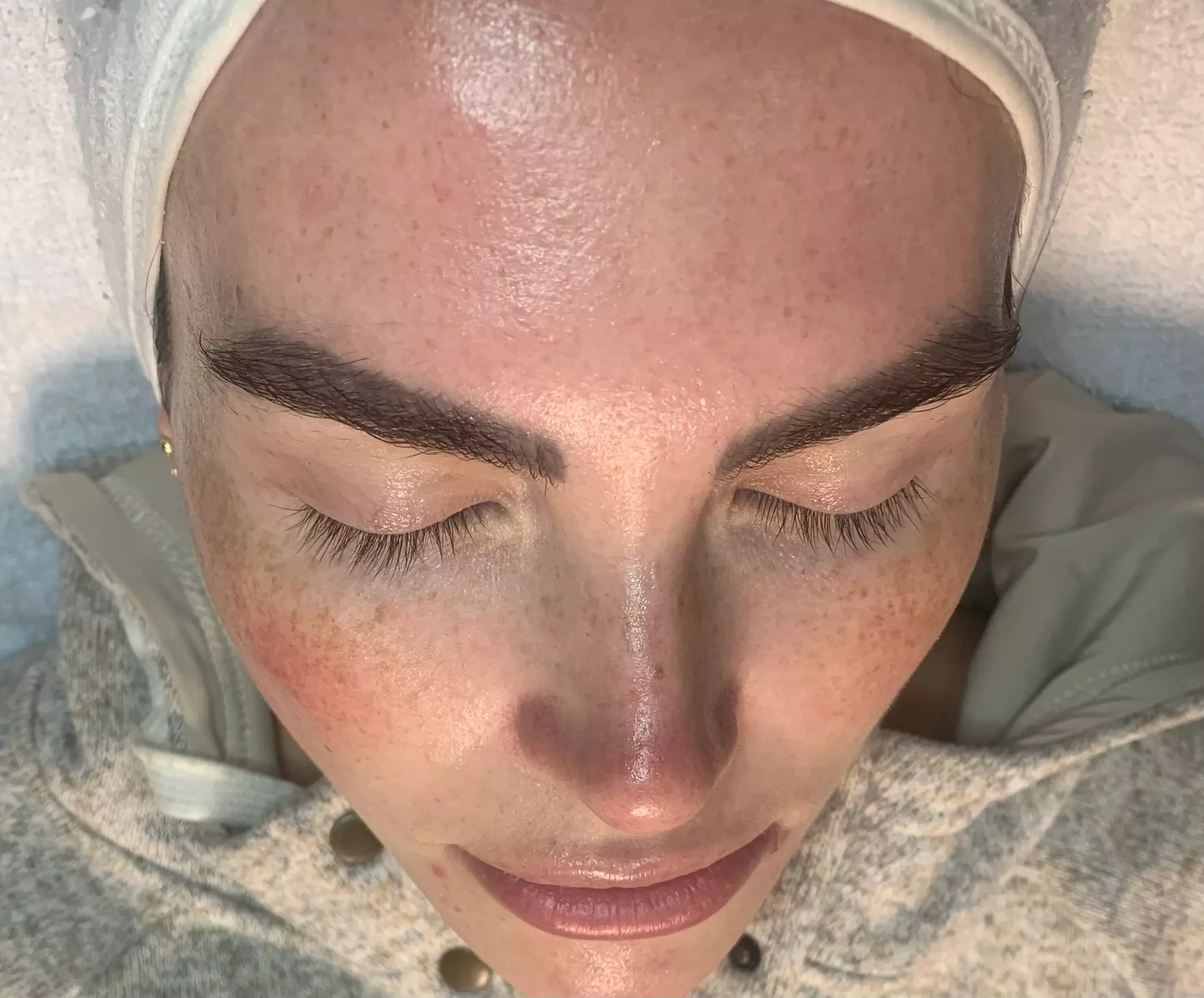 Up to 42% Off on Facial at Ski Esthetics - Primary Image