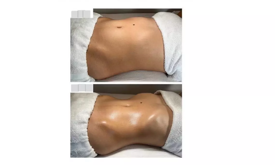 Up to 38% Off on Lymphatic Drainage Massage at Eight30 Body Factory - Primary Image