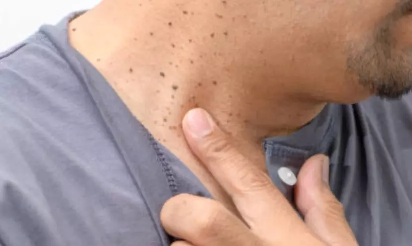 Experience The Salt Box's Smooth Skin Transformation with 5, 10, or 20 Removals up to 45%