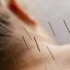 Image 1: Acupuncture Consultation + Treatment w/ Full-Body Red Light Therapy