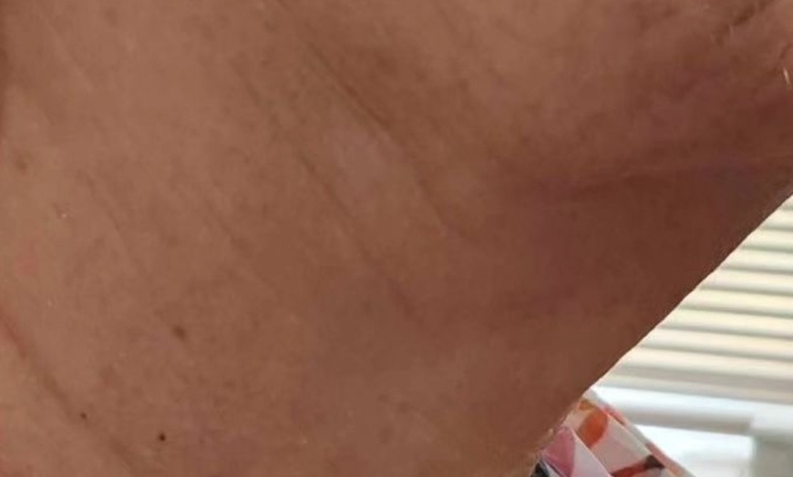 Image 1: Revitalize with a One or Two Sessions of HIFU Full Face & Neck 