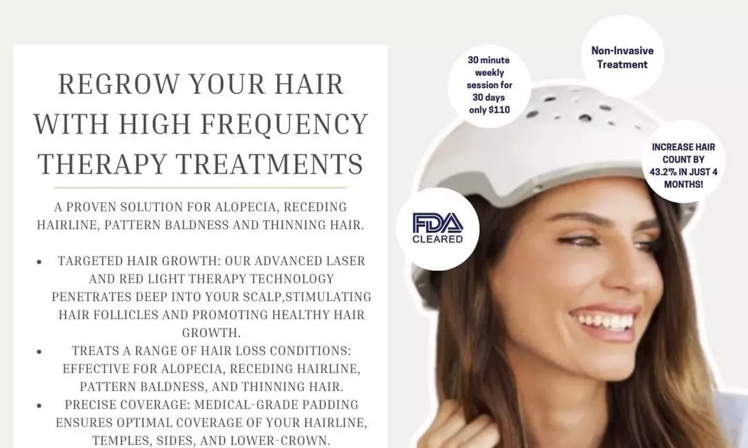 High Frequency Hair Loss Treatments With Consultation at Snobbish Luxury Medical Wig Company (Up to 60% Off) - Primary Image