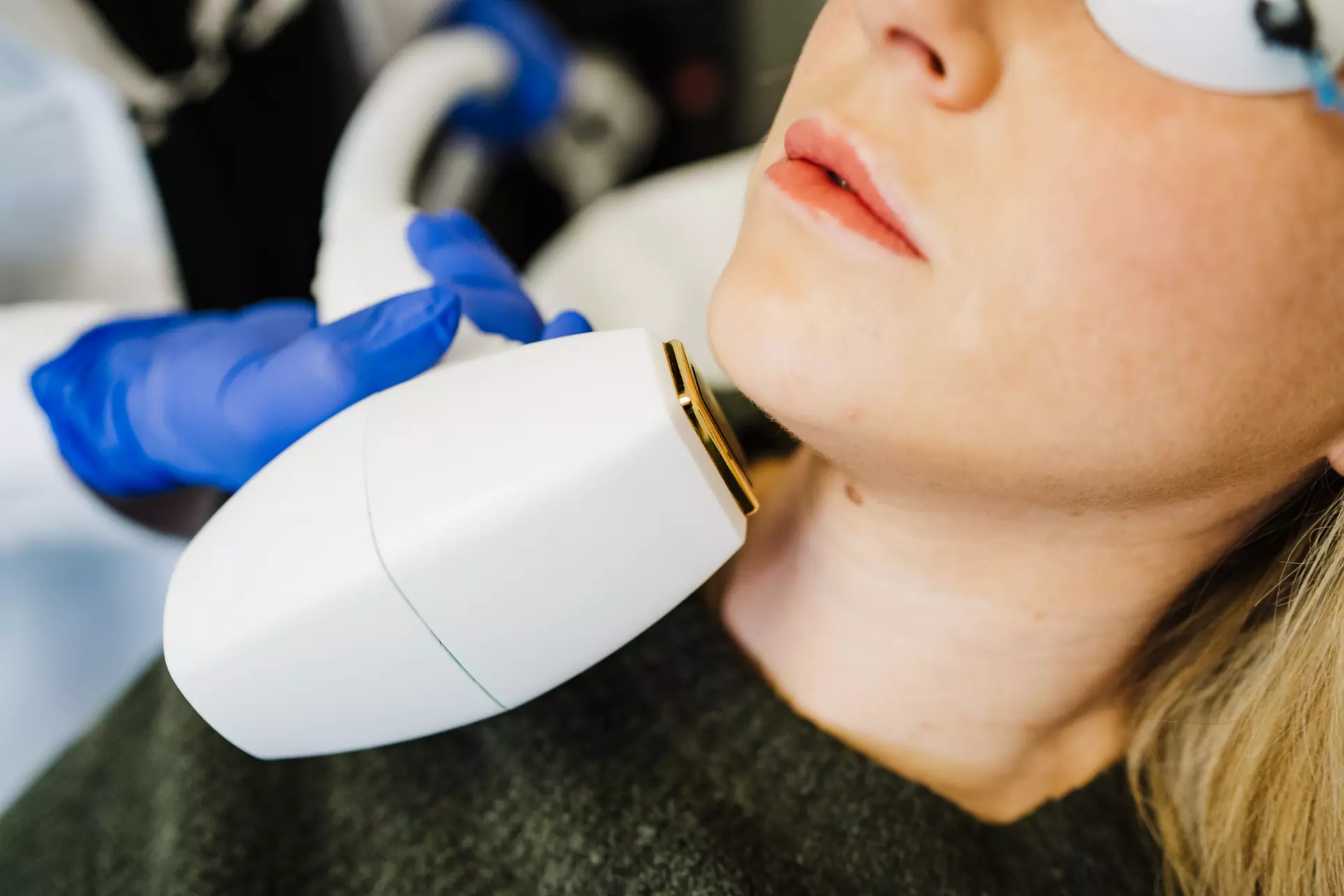 Up to 32% Off on Laser Hair Removal at Sunday Skin - Primary Image