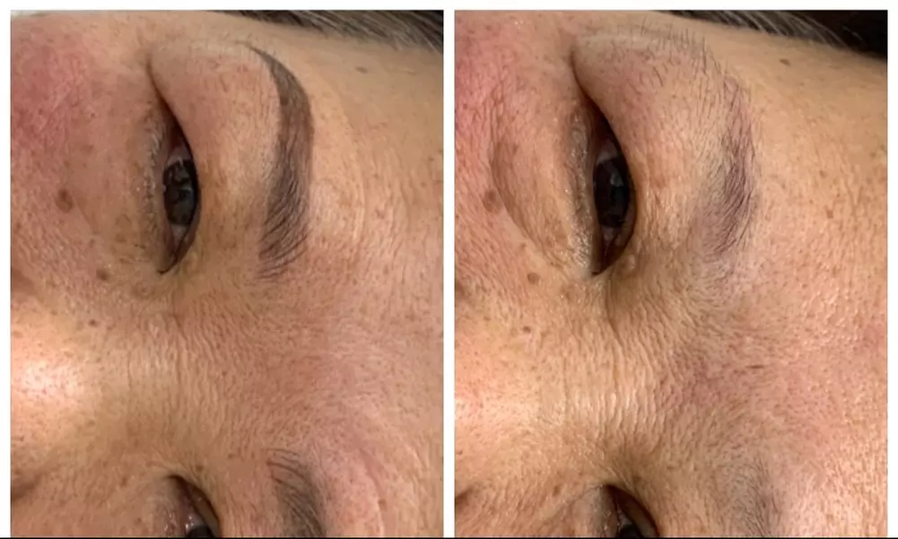 Explore Grace's Brows microblading and scalp micropigmentation with options for touch-ups, offering up to 50% off. - Primary Image