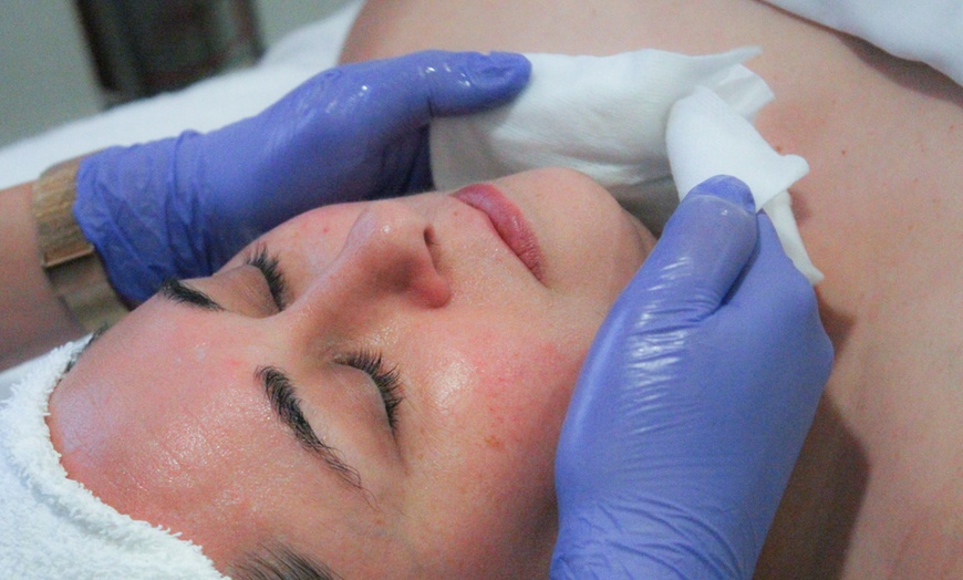 Image 1: Refresh Skin: Spa Rx Facial w/ Chemical Peel, & LED Light 1/2 Sessions