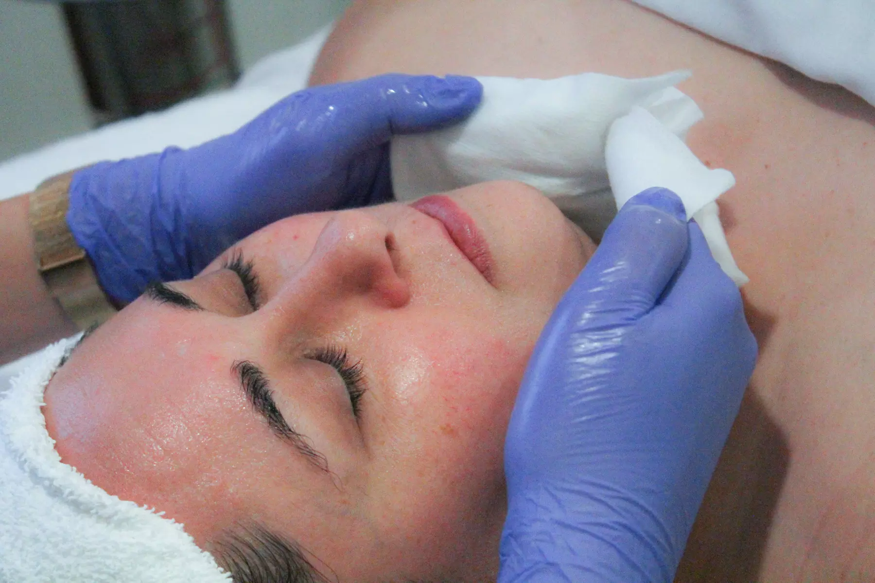 Transform Your Look with Spa Rx Facial w/ Chemical Peel, & LED Light 1 / 2 Sessions (Up To 55% Off) - Primary Image