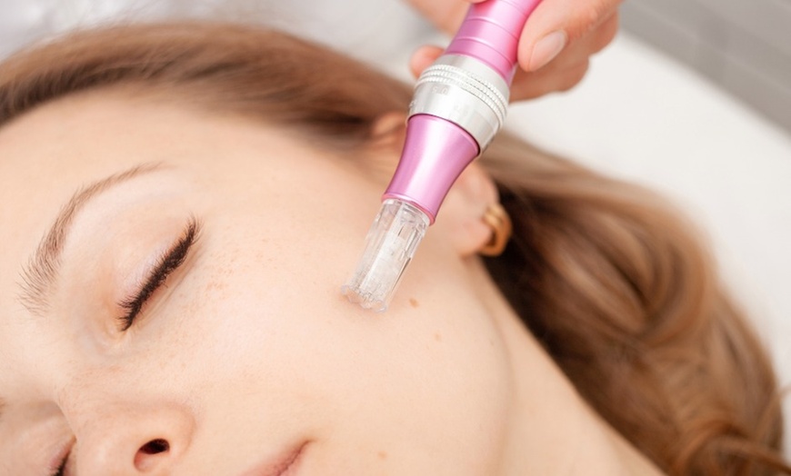 Image 3: Up to 49% Off on Micro-Needling at MAJESTIK AESTHETICS LIMITED