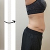 Image 3: Up to 87% Off on Electrical Muscle Stimulation at Advanced Body Design & Wellness