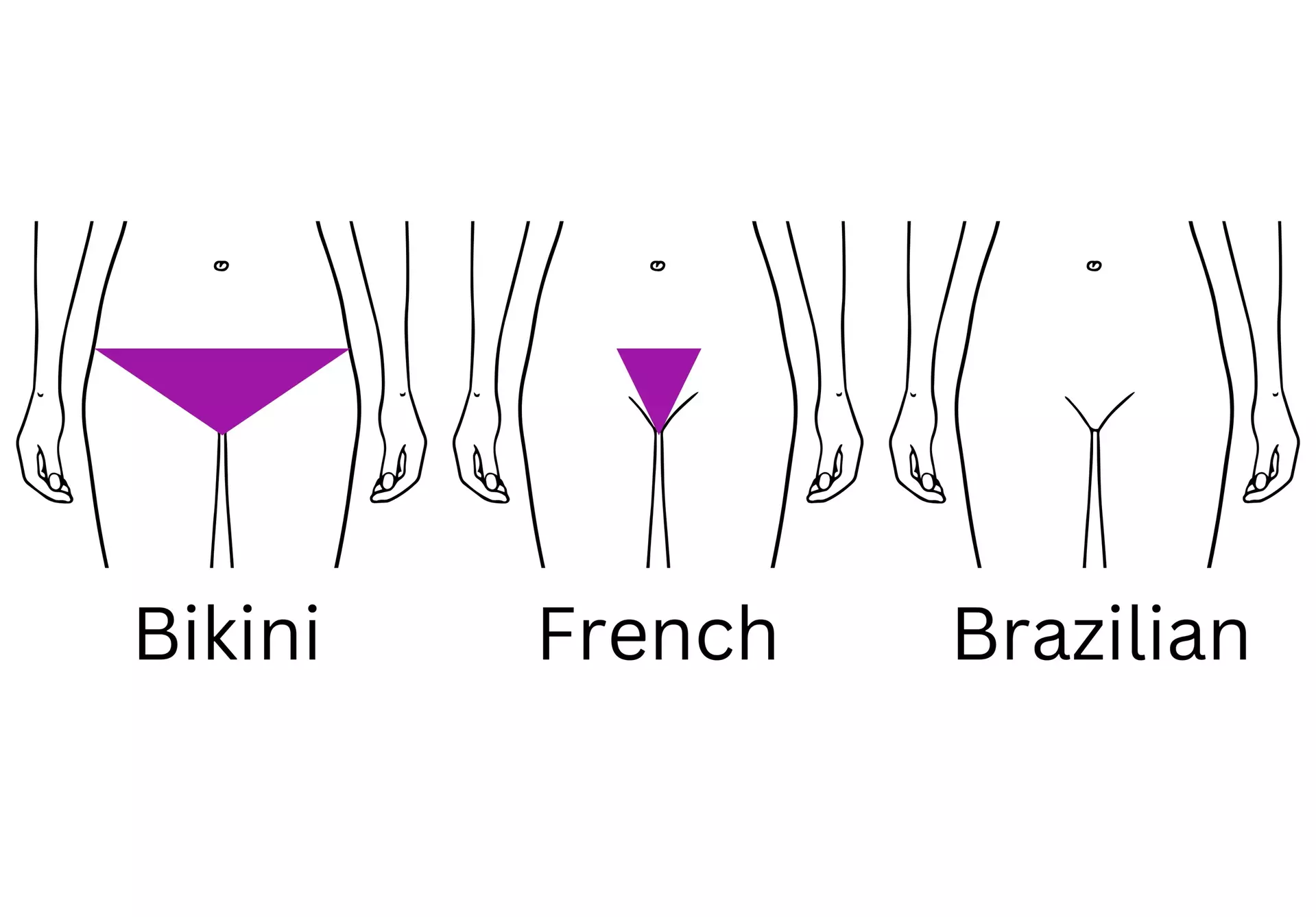 Up to 10% Off on Waxing - Brazilian at Ursula Versace Aesthetics
