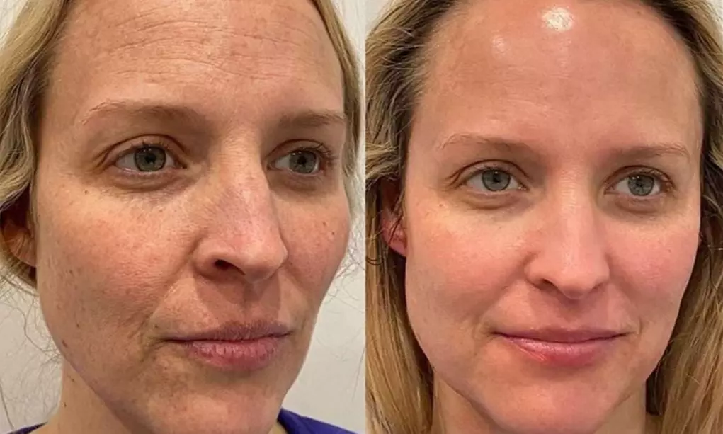 Up to 40% Off on Facial at Luxe Beauty Day Spa & Aesthetics - Primary Image