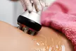 4-in-1 Body Sculpting Treatment or 60-Minute Post Op Massage or Wood Therapy Body Sculpting (Up to 61% Off) - Second Medium