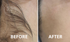 Smooth Skin w/ One Laser Hair Removal for Under Arms, Full Face, Full Brazilian, Mankini & More (Up to 60%Off) 