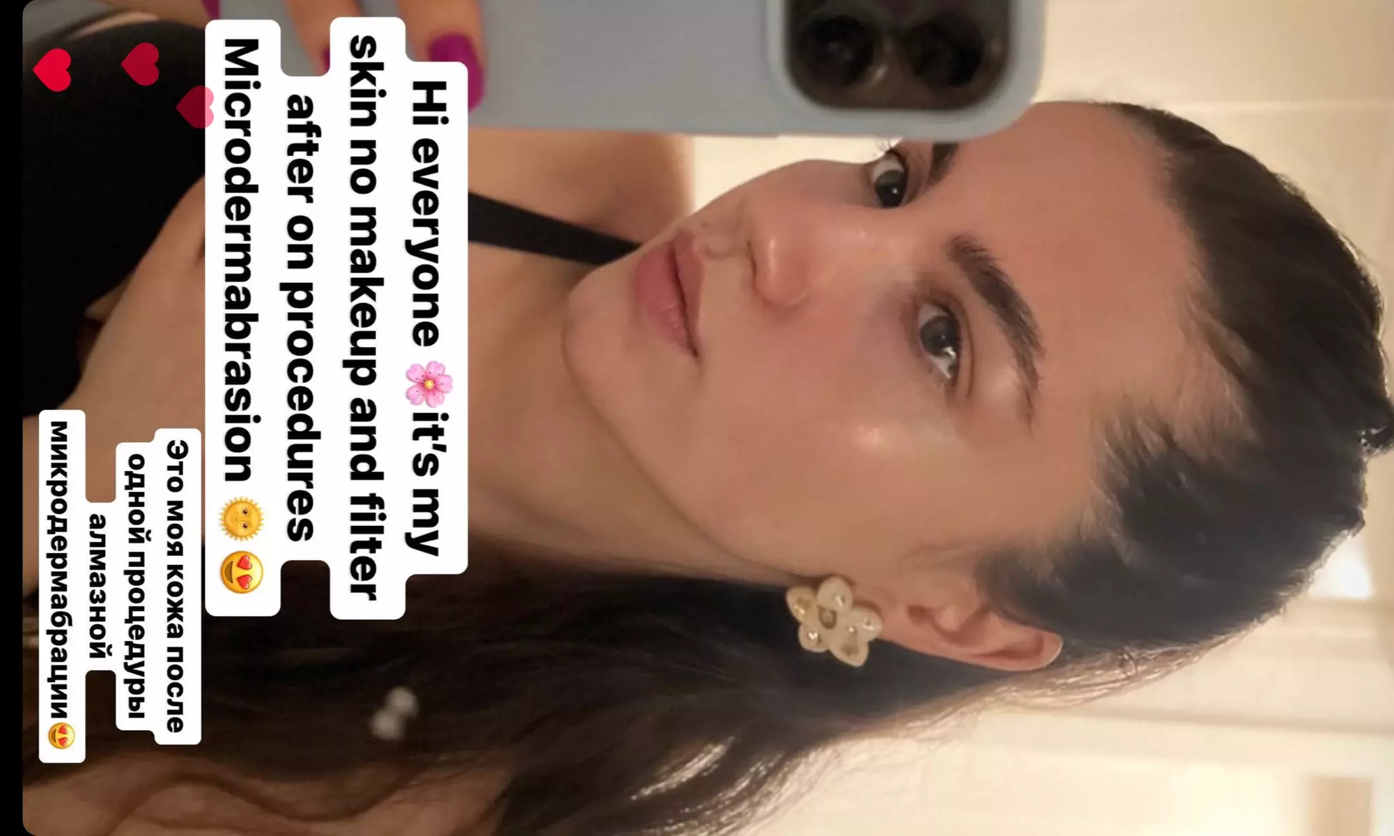 Up to 37% Off on Microdermabrasion at Whole skincare