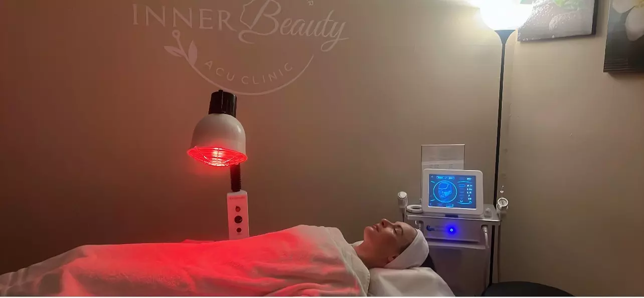 One or Three Body & Facial Acupuncture Treatment w/ Cupping & Massage