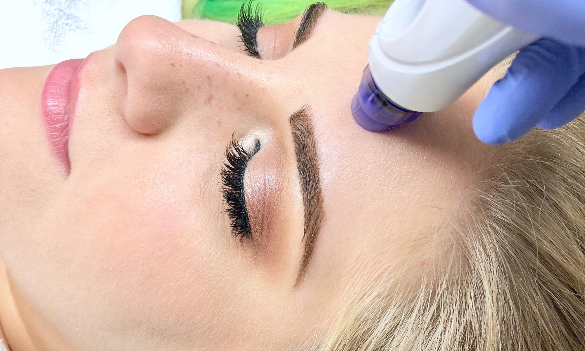 Revitalize Your Skin with Rejuvenating Hydrafacial Options