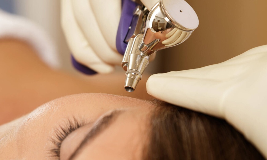 Image 3: Up to 69% Off on Facial - Oxygen at UK Aesthetics Lounge