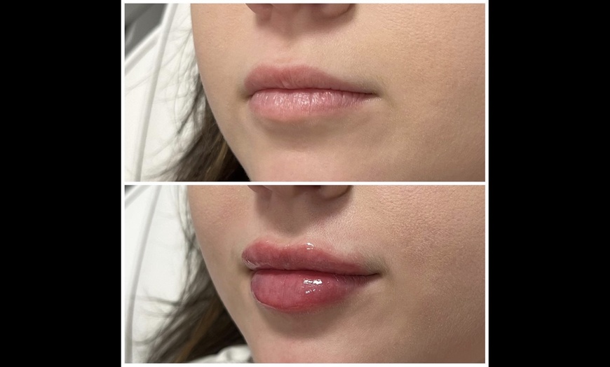 Image 5: Up to 50% Off on  at Dermaesthetics